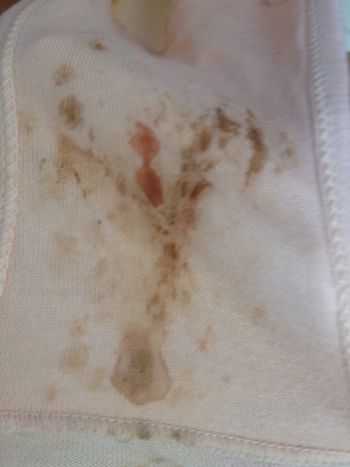 怀孕五个月,内裤上有血迹求解