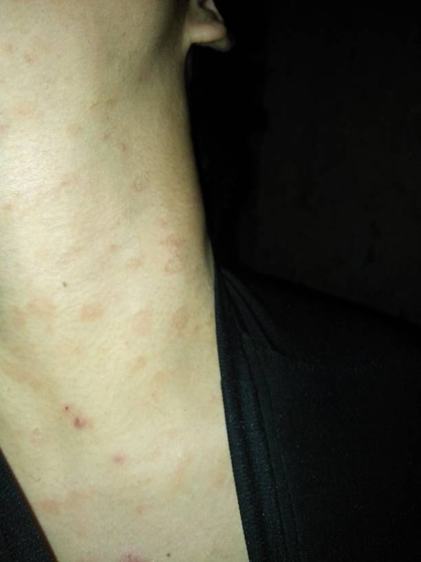 而且现在又有了一些黑色的东西.请问怎么办