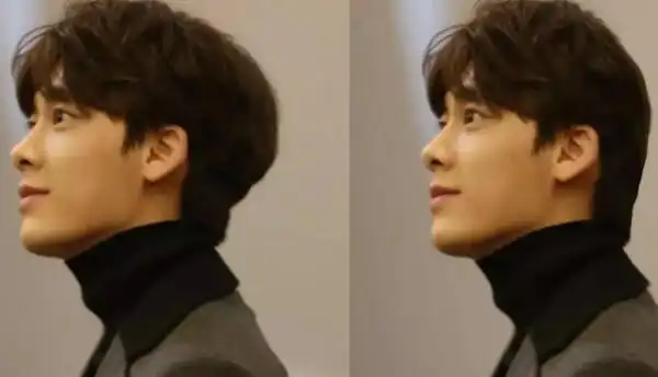 扁平后脑勺的危害对人体无害影响美观婴儿可矫正