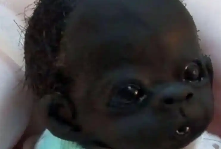在非洲就诞生了一个被誉为全球最黑宝宝的小孩,当时这件事轰动世界,而