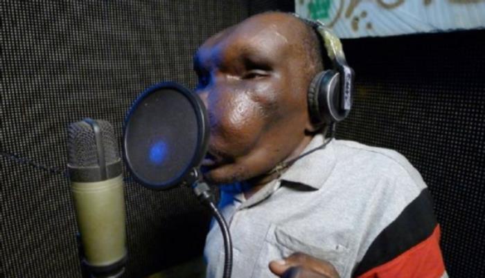 最丑的男生照片世界最丑男事业爱情双丰收