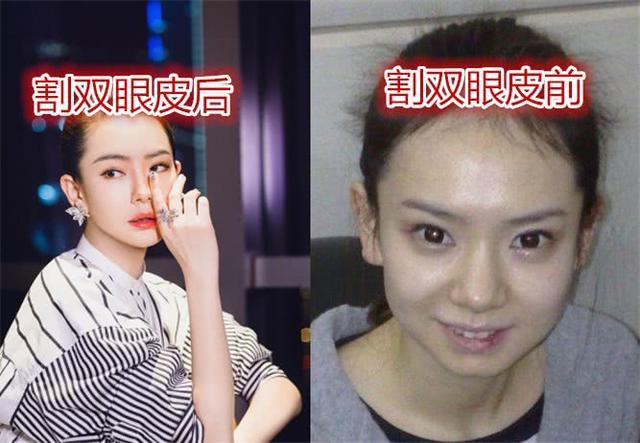 戚薇自曝割双眼皮,前后颜值差别太大,网友:根本不是一个档次