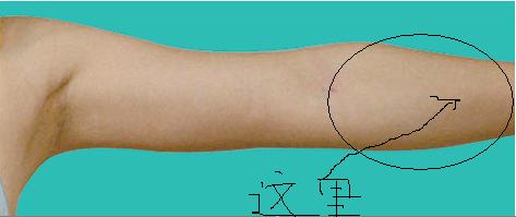 上手臂内侧中间疼怎么回事