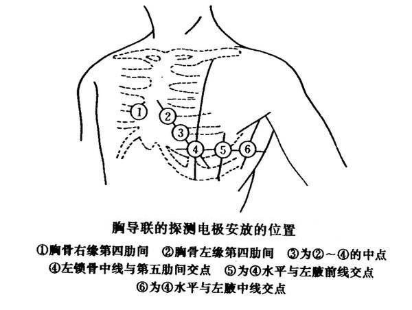6.心电图胸导联位置