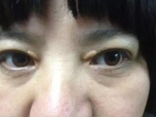 心脏好不好主要看这5个地方逼走心脏病只需3招