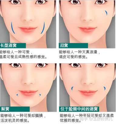 按照位置来看,应该是属于酒窝了,个人有个人的特点,跟标准不一定是一