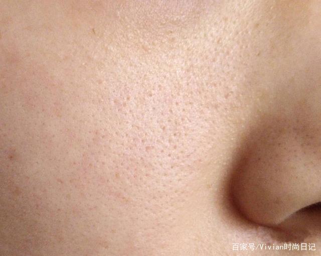 关于收缩毛孔,据说99%的人都做错了,找准原因才能对症下药