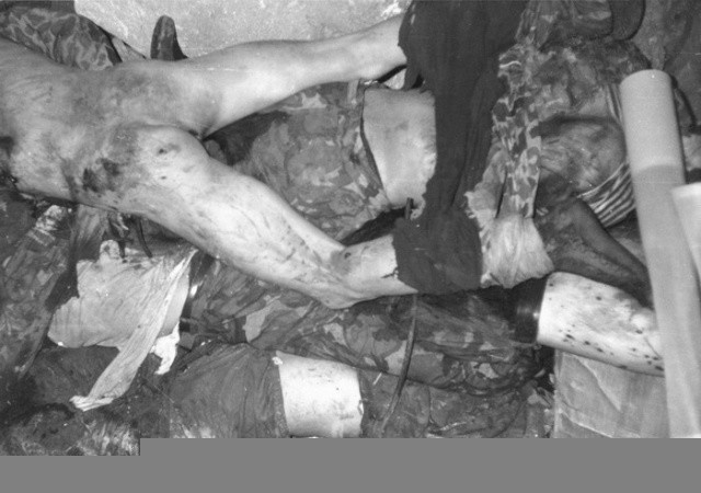 中越战争黑色瞬间