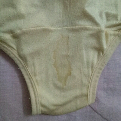 孕十周多了,白带特别多,有时候是白色的,背面不会印出来,有时候背面