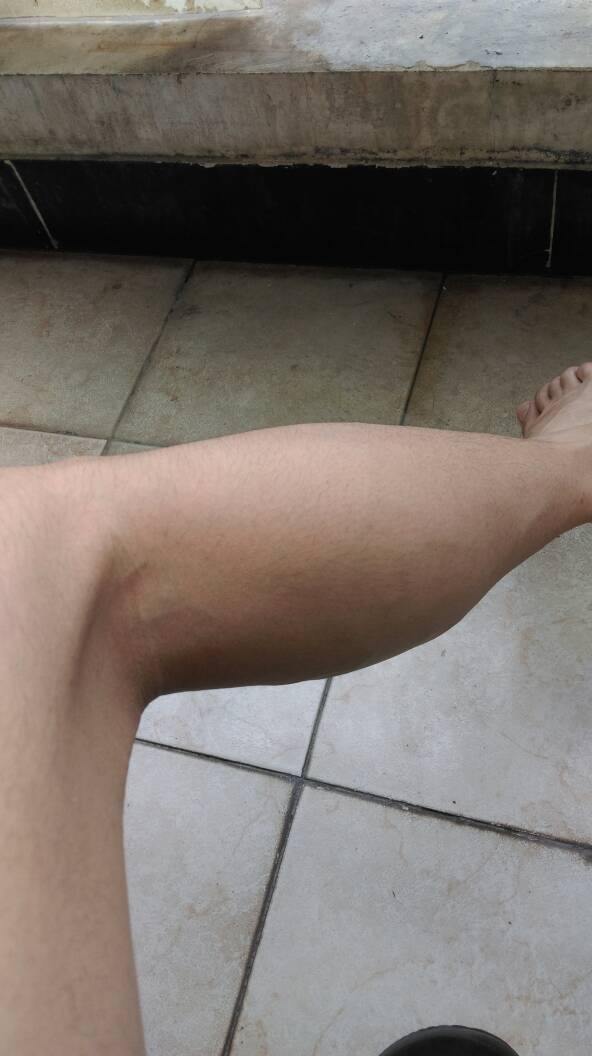 我是男生 腿太粗 能有什么好的有效果的瘦腿方法呢?谢谢