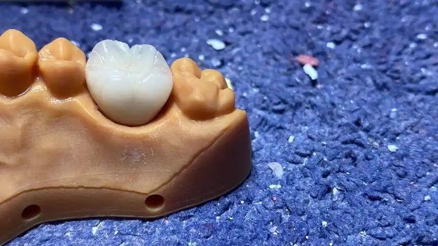 牙齿07 #纯手工雕刻 #一口好牙  美丽笑容,从齿开始07#美牙修复