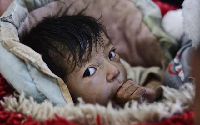 王菲李亚鹏创办的嫣然天使基金究竟在做些什么