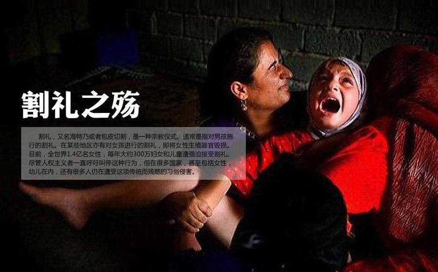 1男性割礼指男性割包皮女性割礼,在非洲等地实行的把少女的全部生殖器