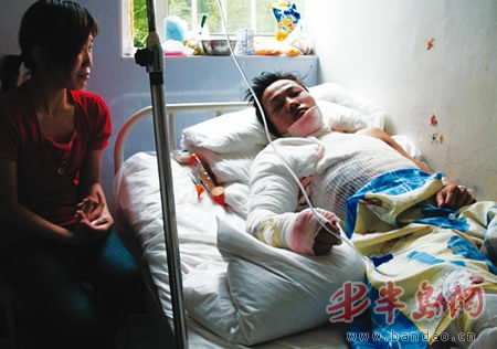 烧伤的小杨(右)浑身缠满了绷带