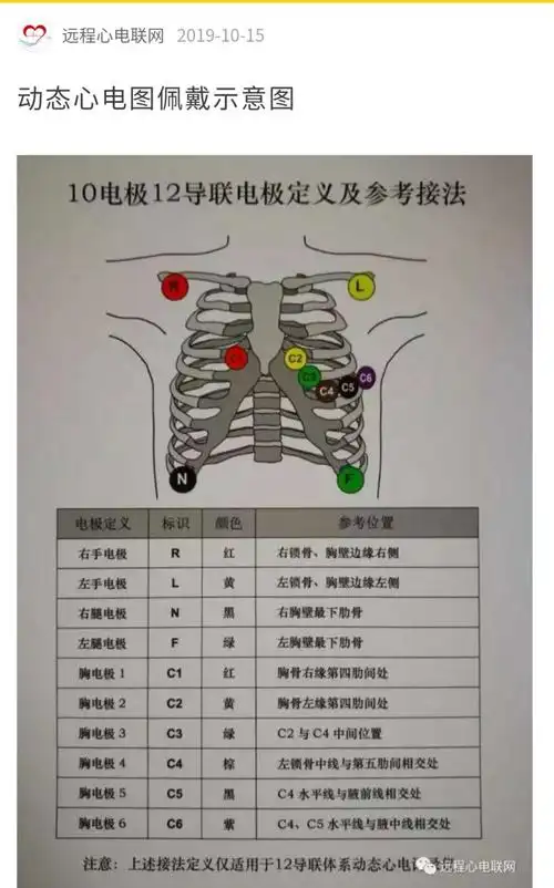 24小时动态心电图