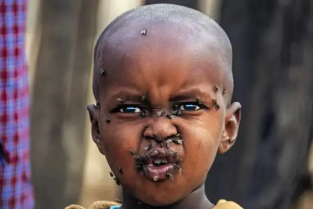 照片里有一个来自非洲的一个小男孩不仅骨瘦如柴还浑身爬满苍蝇,这个