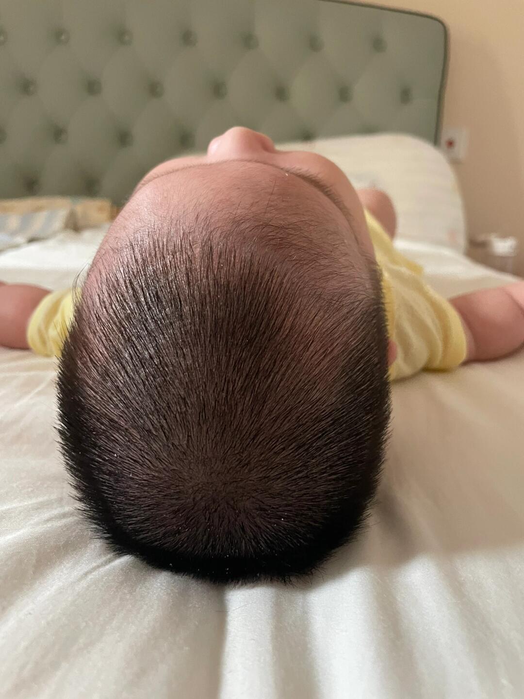 这个头型改怎么睡#睡头型  #宝宝睡头型  #婴儿头型到底怎么睡  #如何