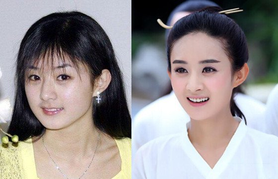赵丽颖整容前后照片曝光 包子妹以前的脸更圆!