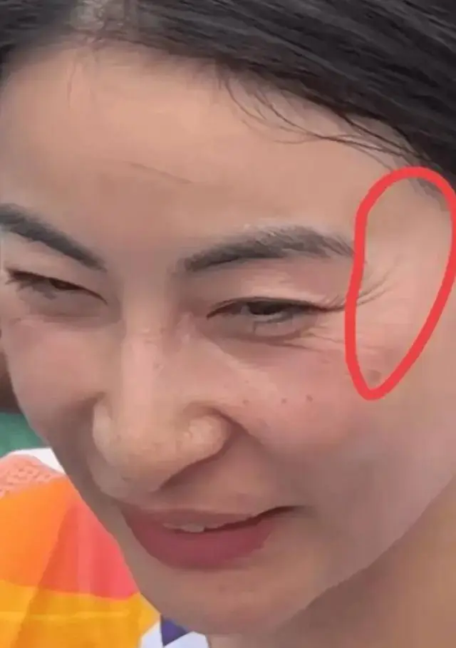 41岁郭晶晶因鱼尾纹上热搜?网友好奇为何不医美?_什么_女人_阴德