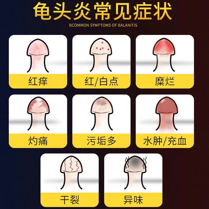包皮龟头瘙痒红肿红点男士护理私膏念珠喷剂私处护理器械