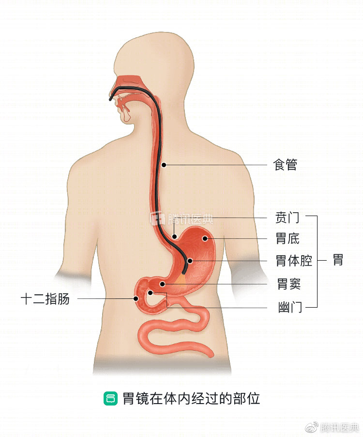 胃底,胃体腔,胃窦,幽门,十二指肠球部,十二指肠降段及乳头部,到达最远