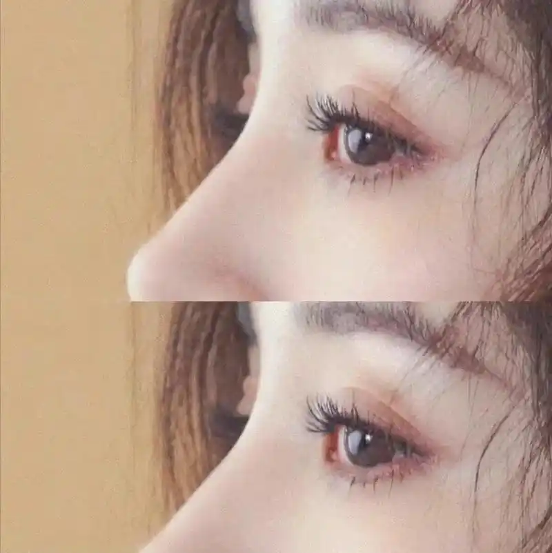 内娱最好看的眼睛啦好好休息等你康复