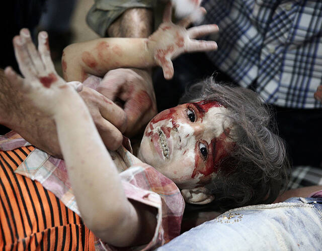 野战医院,在空袭中死去的儿童尸体.