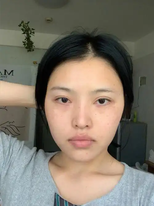 扁平脸高颧骨逆天改命75