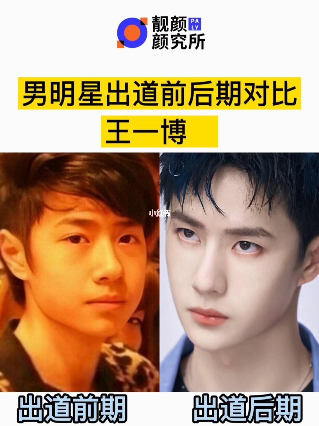 男明星出道前后对比之王一博_王一博_昆明鹏爱靓颜整形医院攻略_中国