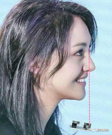 好看的侧脸要符合哪些条件?