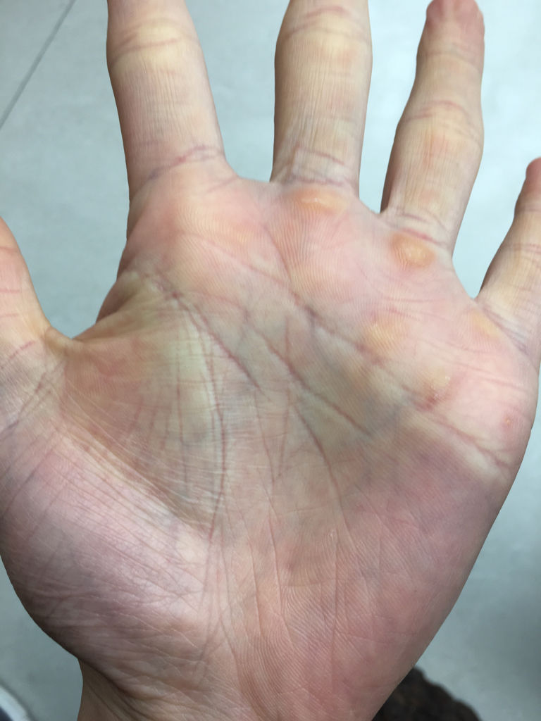 我的手相智慧线断了是怎么回事啊,求解答一下,谢谢!