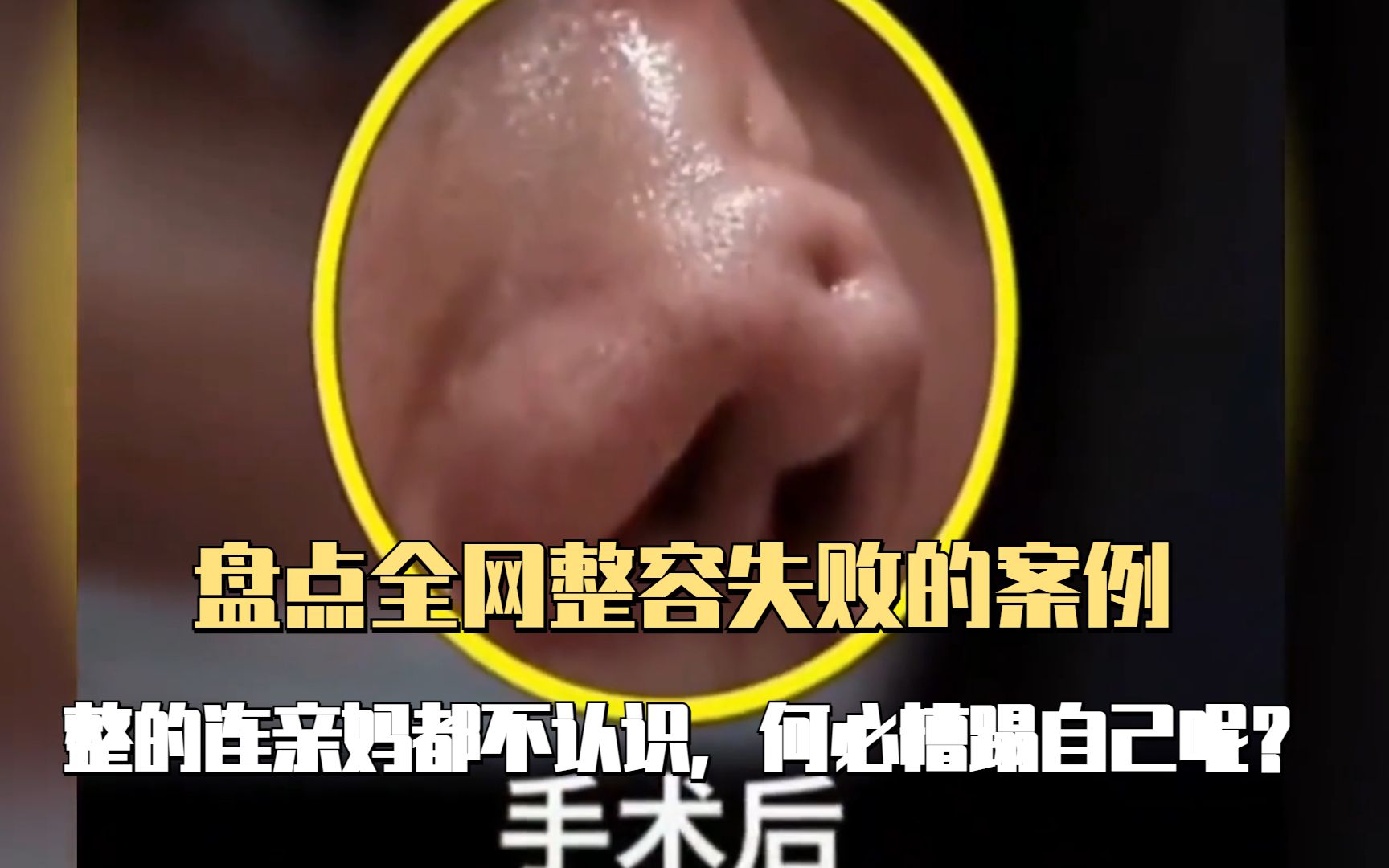 盘点全网整容失败的案例,整的连亲妈都不认识,何必糟蹋自己呢?