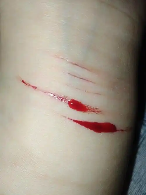 怎么割手臂才能死去,我感觉如果现在离开这个世界,就会好一些.