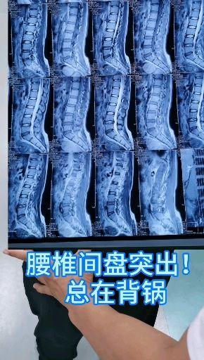 田医生教大家预防办公室职业病