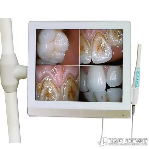 口腔内窥镜一体机
