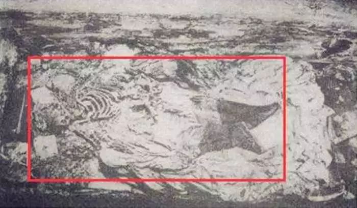 还是将尸骨复原之后右腿明显比左腿短的情形,都可以证明万历皇帝生