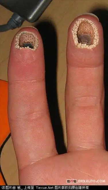 绝对不要手贱去百度以下这些词语……后果自负_女人&大小姐_汝州论坛