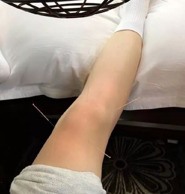 也为了拍打戏,留下后遗症,膝盖严重积水,所以很长时间每天早上开工都