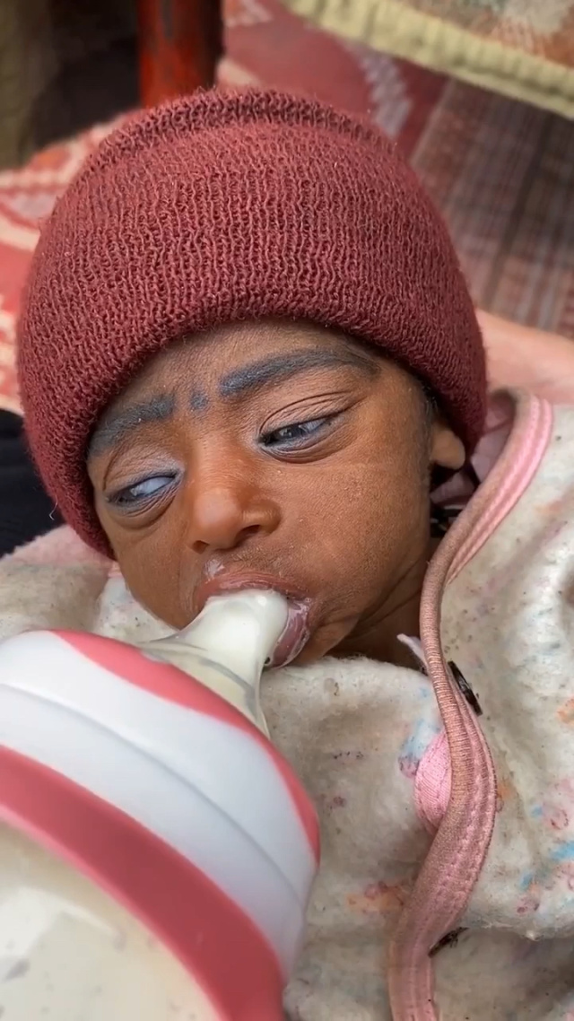 今天刷视频,看到这个黑人宝宝,莫名的好心疼96愿天下的孩子可以健康