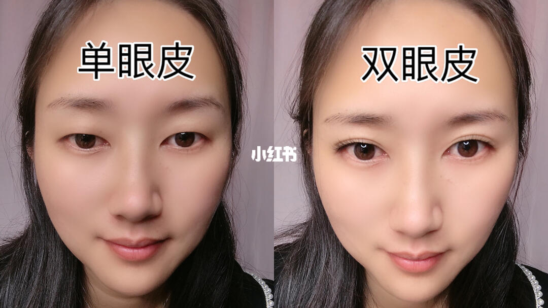 单眼皮和双眼皮差距好大