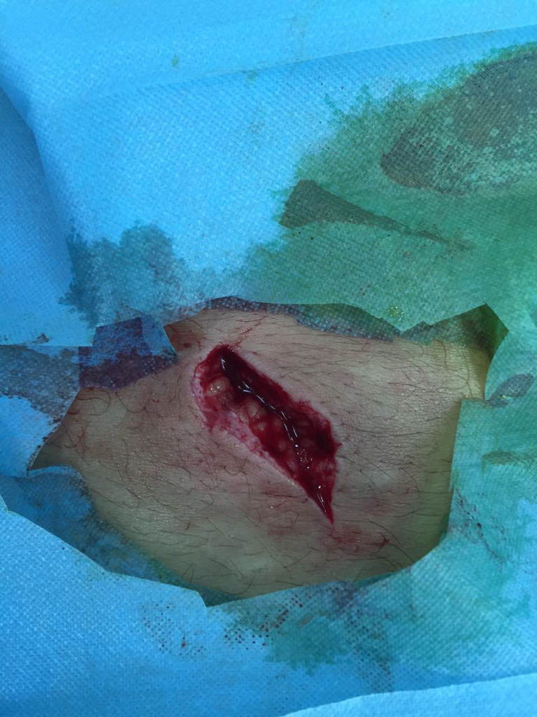 我被人拿匕首捅伤,捅到腰部,伤口长4厘米,深8厘米,头部也有刀伤,是否