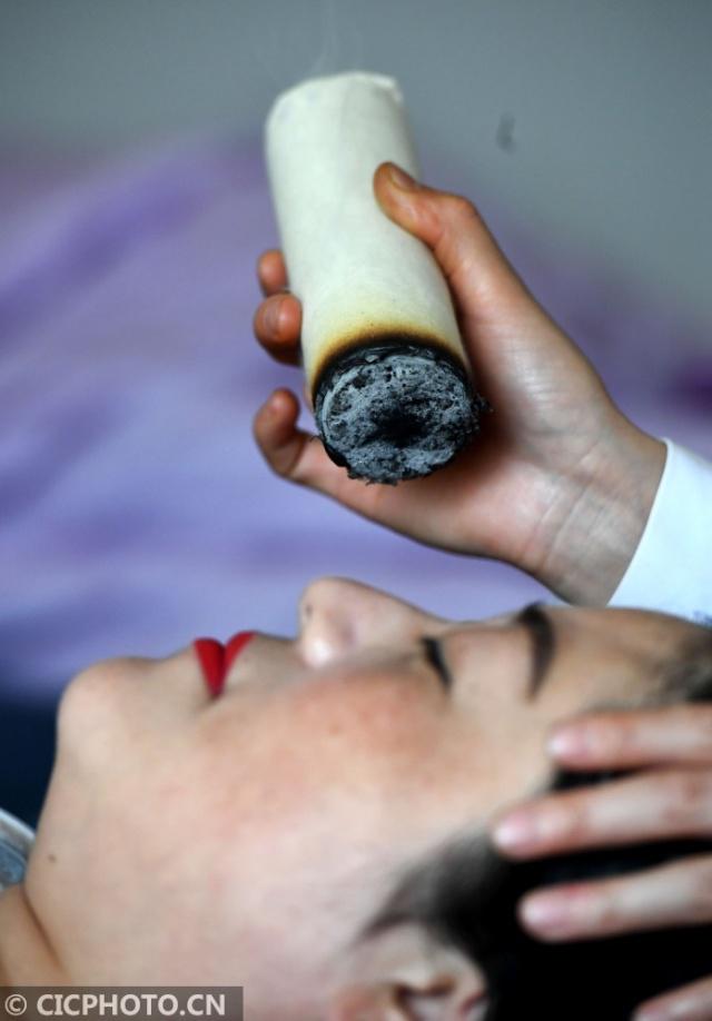 80后牛静的艾灸情结