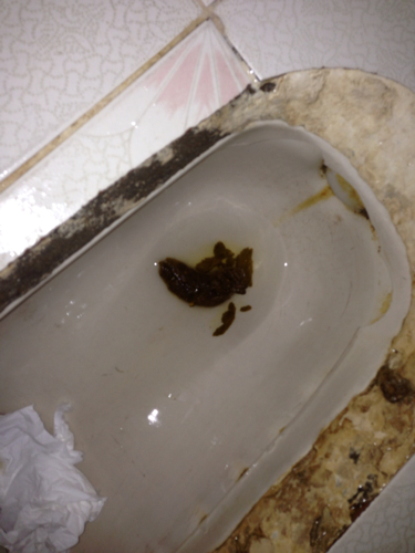 对不起,有点恶心.这个大便颜色正常么?