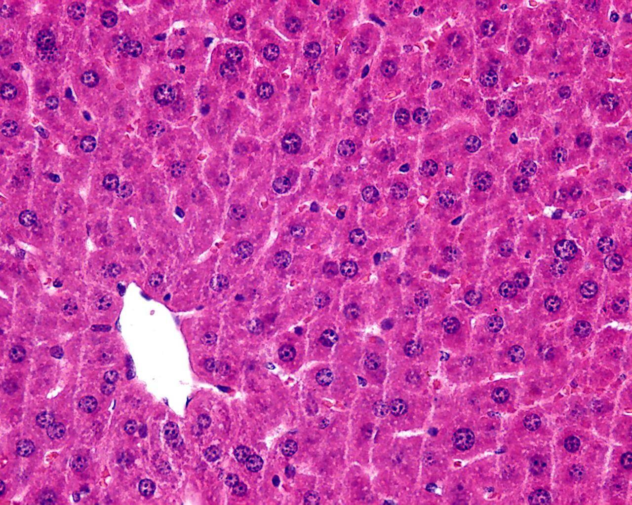 求指导肝病理切片,不知道如何描述