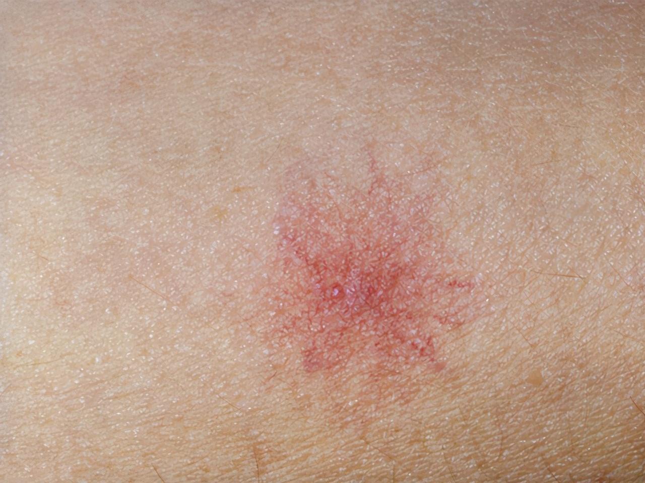 38岁男子不碰烟酒,却因肝癌离世!医生怒斥:妻子是罪魁祸首