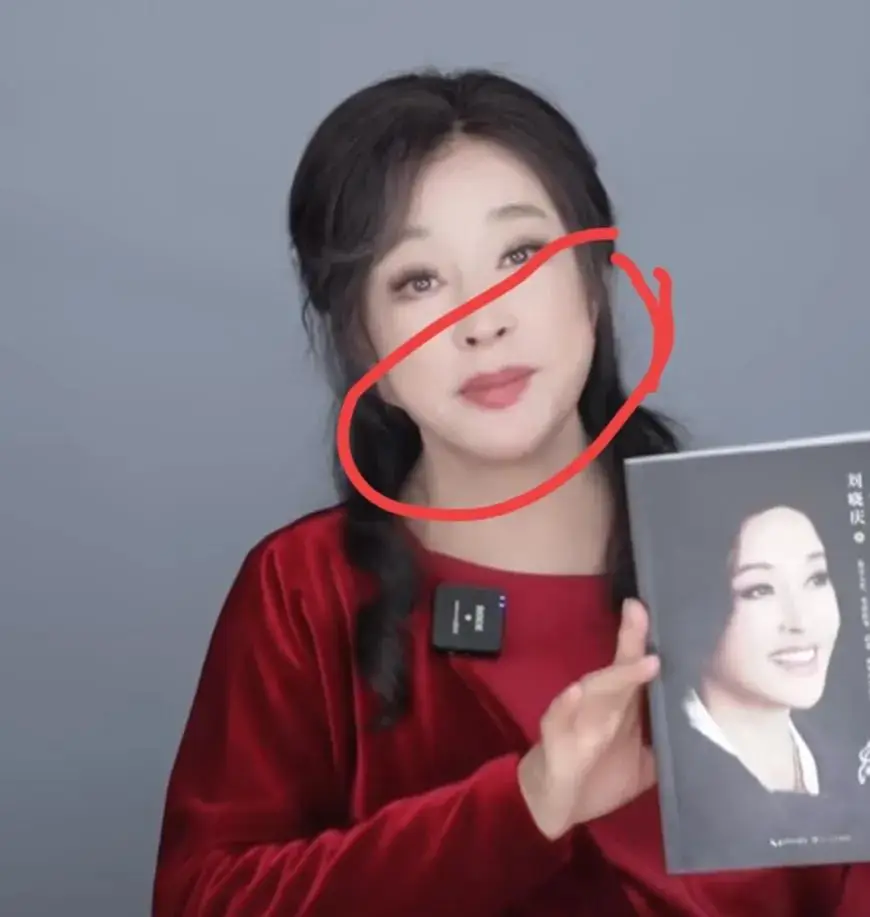 70岁刘晓庆最新近况曝光,面部僵硬做表情困难,医美后遗症太明显_少女