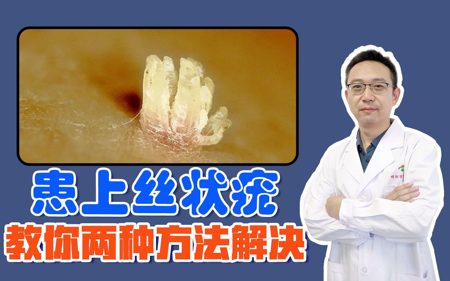 患上丝状疣,教你两种方法,轻松去除不复发