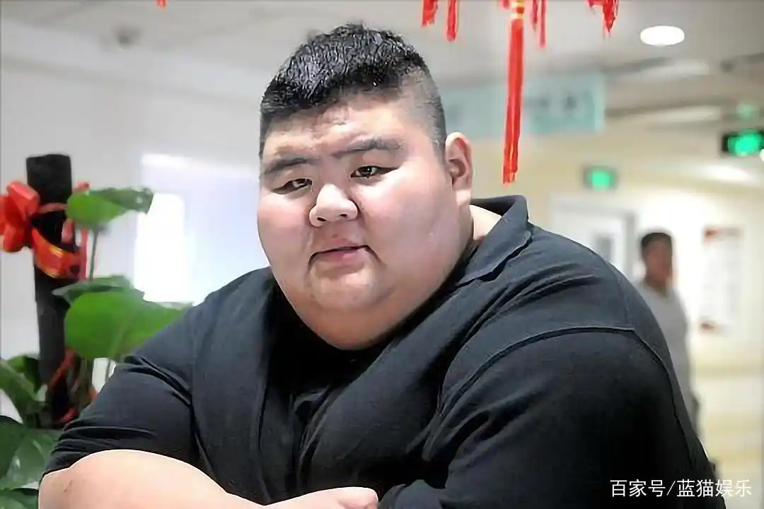 还记得668斤胖子王浩男吗?一年减掉456斤之后,如今变得认不出