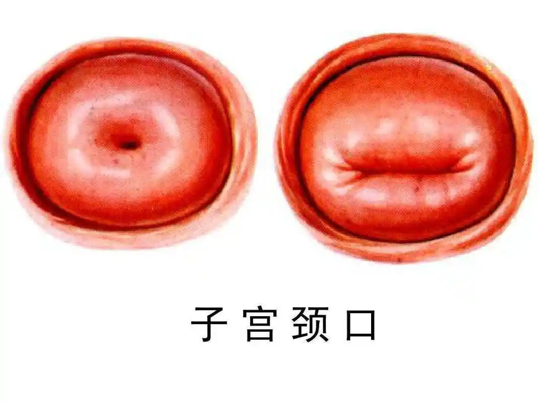 正常子宫颈口多大