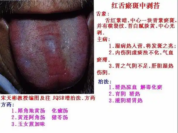 疾病信号百张图解舌诊做自己的医生